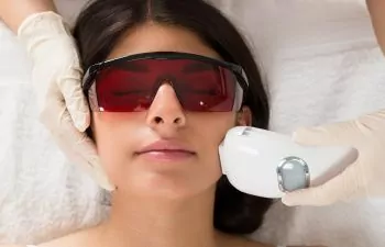 Woman Receiving Facial Laser Hair Removal Atlanta GA